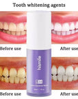 Teeth Whitening